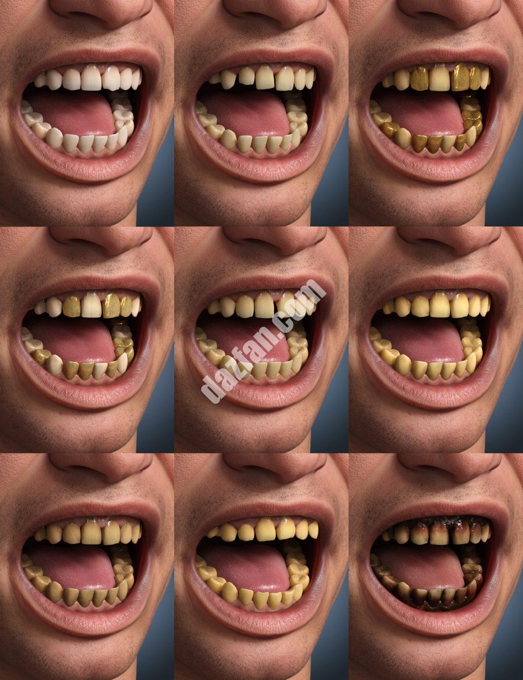 [daz角色] Genesis 9的牙齿要素形状和材料-DAZ爱好者