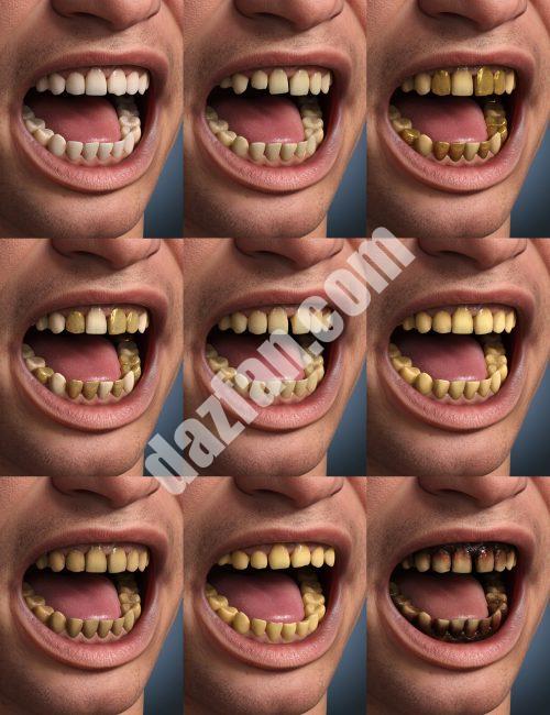 [daz角色] Genesis 9的牙齿要素形状和材料-DAZ爱好者